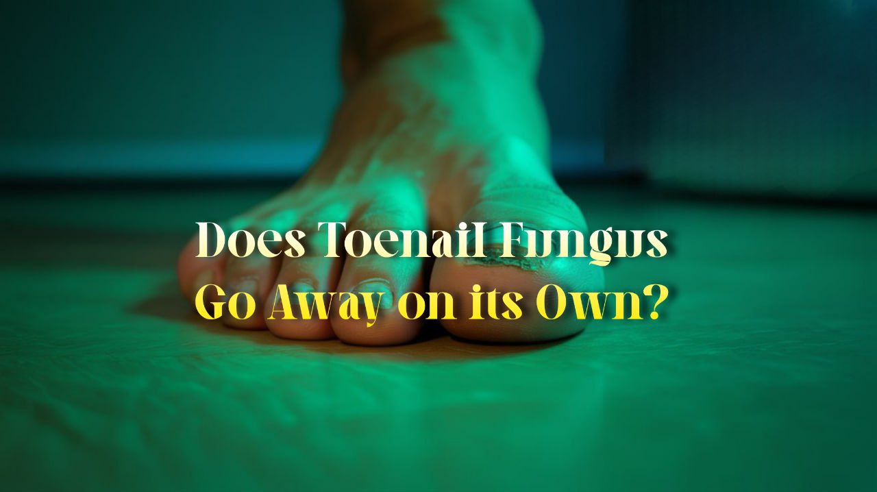 Does toenail fungus go away on its own?
