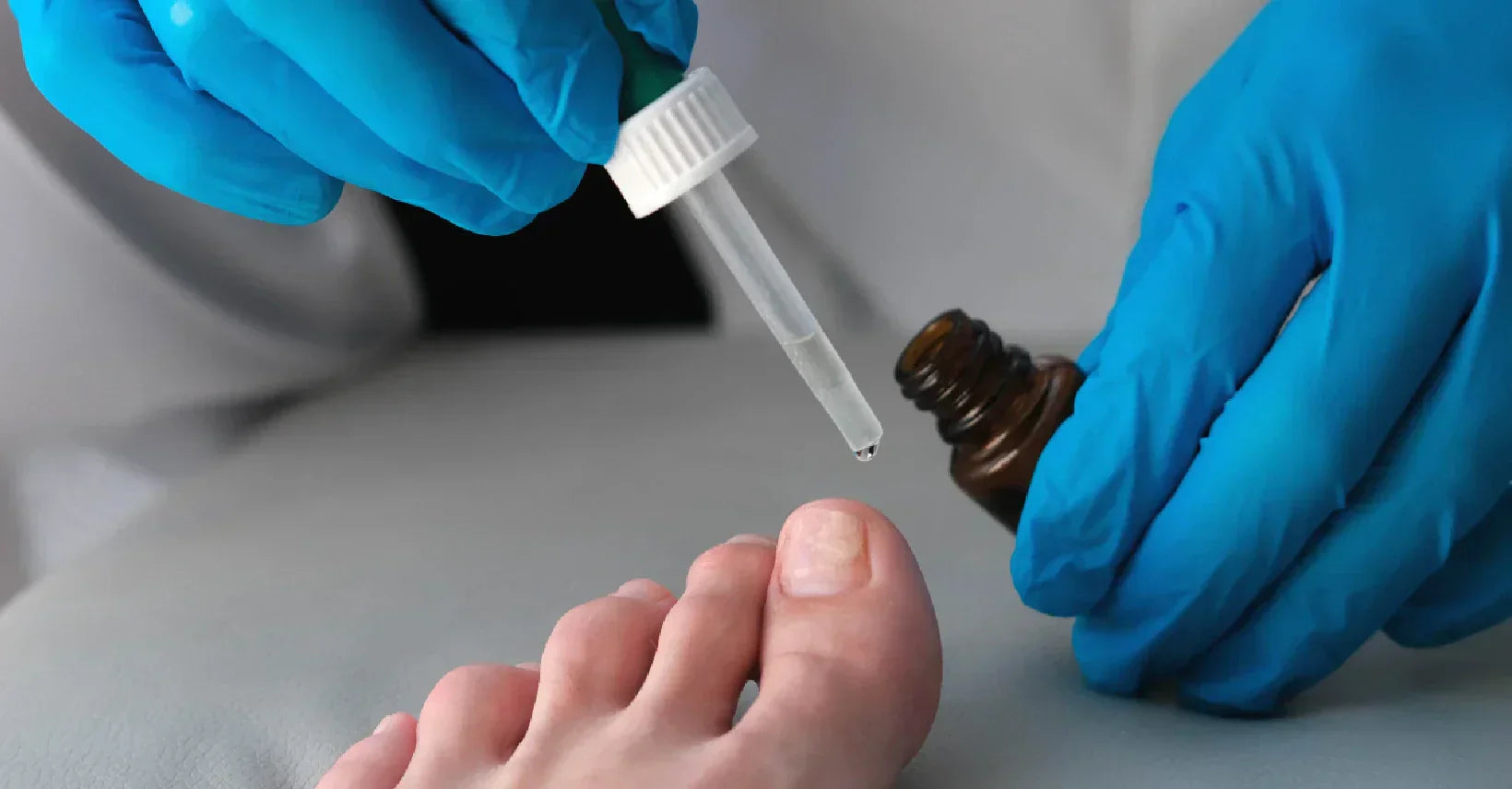 Does Alcohol Kill Toe Fungus