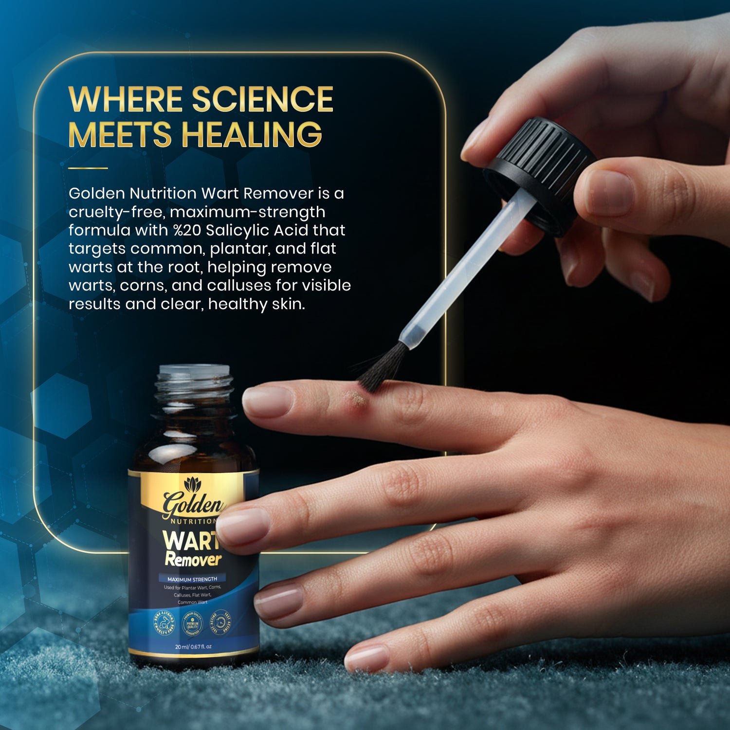 Golden Nutrition Wart Remover – Maximum Strength Formula (20ml)