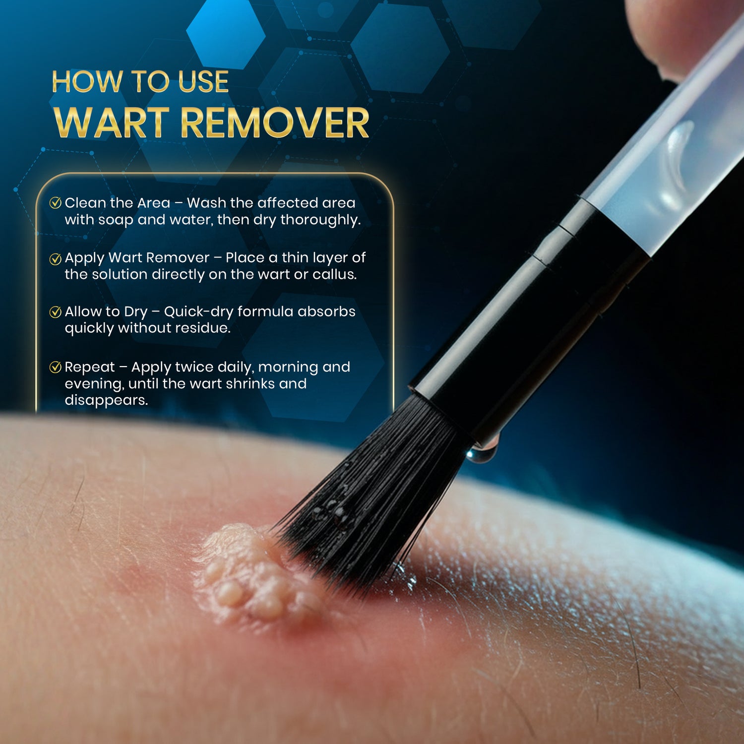 Golden Nutrition Wart Remover – Maximum Strength Formula (20ml)